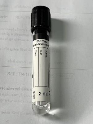 1.6ml ESR لوله خلاء با 3.8٪ سیترات سدیم برای نرخ رسوب